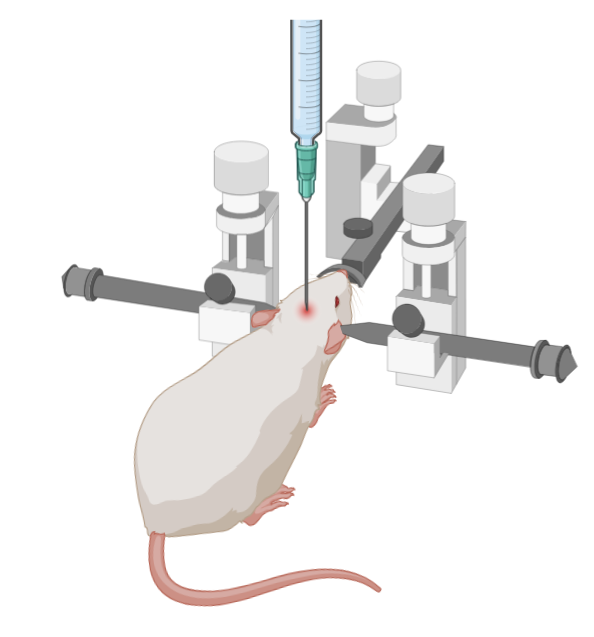 Stereotaxic surgery